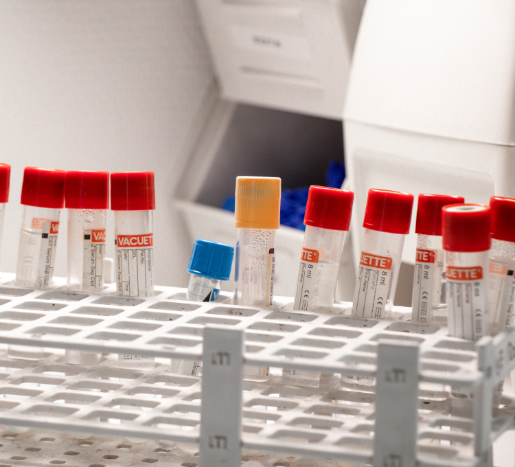 Diagnostik und Therapie von Allergien